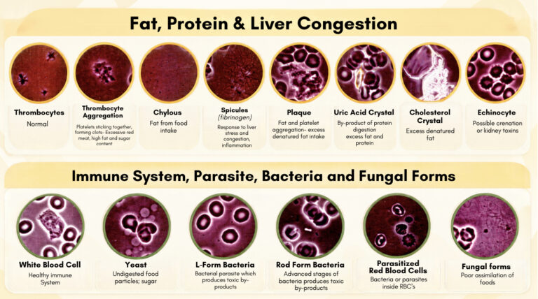 Sunshine Holistic Health Live Blood Analysis