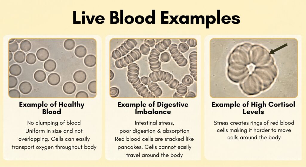 Sunshine Holistic Health Live Blood Examples