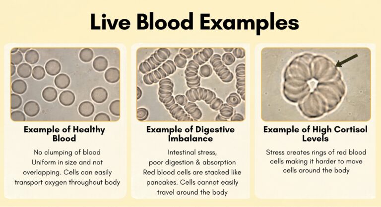 Sunshine Holistic Health Live Blood Examples
